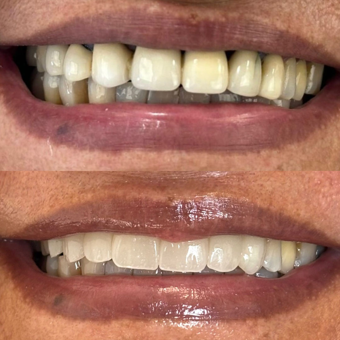 melo e menezes resultado 2